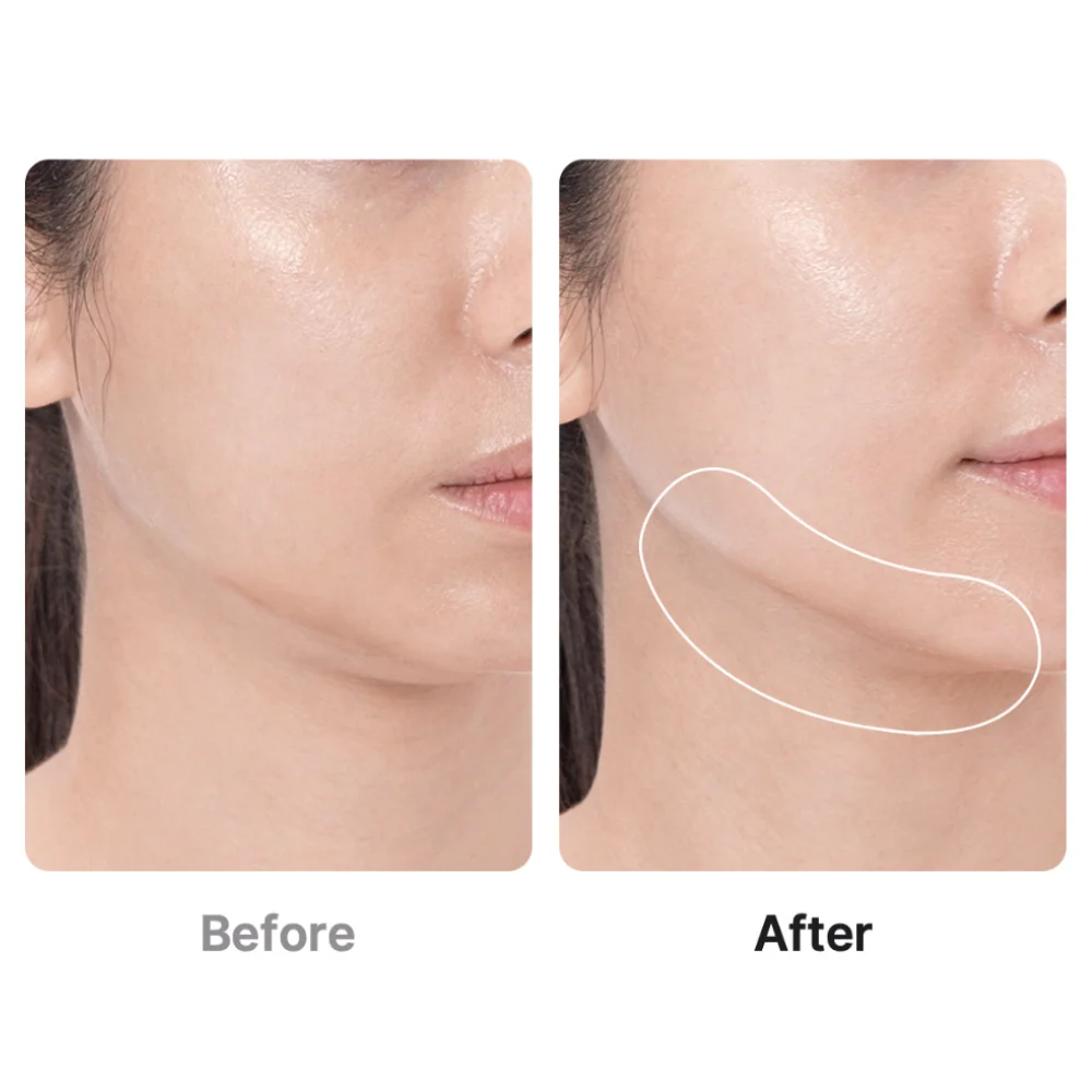 AGE-R Booster Pro (Ipc)