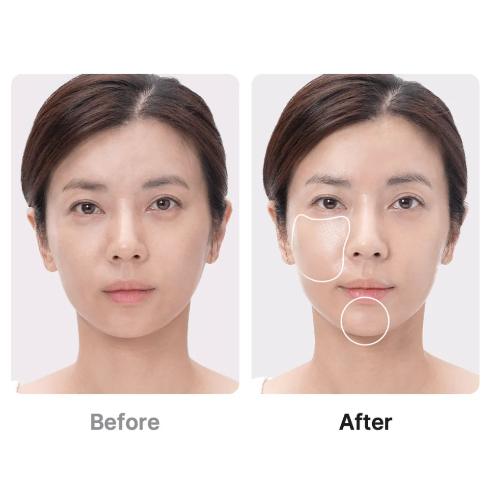 AGE-R Booster Pro (Ipc)